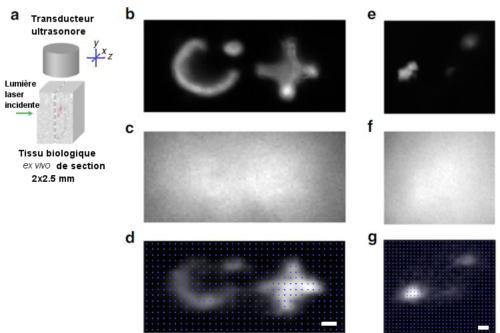 image_2_focalisation _digital con_phase _ fluo_500 Voir par fluorescence à l’intérieur du corps humain