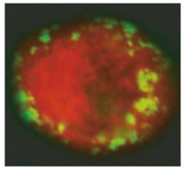Un vaccin révolutionnaire sans anticorps qui protège les macaques du virus VIS analogue du SIDA
