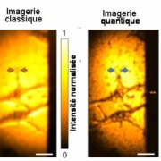 Fig.3 Image de cellules cancéreuses par microscopie à intrication quantique Images, classique (à gauche) et quantique (à droite) de 2 cellules HeLa Barres d’échelle 20 µm. Tiré de Quantum microscopy of cells at the Heisenberg limit Zhe He, Yide Zhang, Xin Tong, Lei Li & Lihong V. Wang. Nature Communications | (2023) 14:2441. CC BY license 4.0