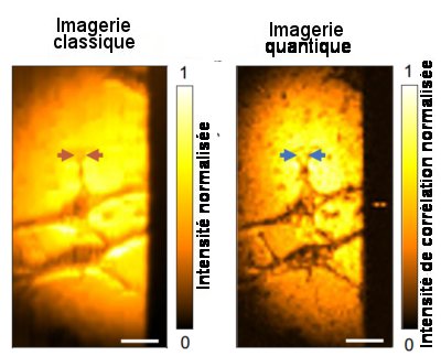 Fig.3 Image de cellules cancéreuses par microscopie à intrication quantiqueImages, classique (à gauche) et quantique (à droite) de 2 cellules HeLa Barres d’échelle 20 µm. Tiré de Quantum microscopy of cells at the Heisenberg limit Zhe He, Yide Zhang, Xin Tong, Lei Li & Lihong V. Wang. Nature Communications | (2023) 14:2441. CC BY license 4.0