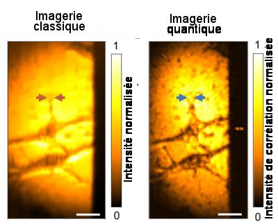 Fig.3 Image de cellules cancéreuses par microscopie à intrication quantique Images, classique (à gauche) et quantique (à droite) de 2 cellules HeLa Barres d’échelle 20 µm. Tiré de Quantum microscopy of cells at the Heisenberg limit Zhe He, Yide Zhang, Xin Tong, Lei Li & Lihong V. Wang. Nature Communications | (2023) 14:2441. CC BY license 4.0