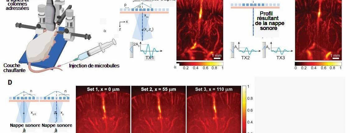 Fig.4.Images NSSM de la vascularisation du cerveau d’une souris prises à vitesse élevée.A) Dispositif expérimental. B) Vue de la vascularisation cérébrale d’une souris acquise après injection de MB par Doppler SSM à 4,4 kHz et utilisation de 2100 images. C) Même section cérébrale qu’en B acquise par Doppler NSSM à 4,4 kHz. D) Doppler NNSM de trois sections adjacentes avec un intervalle de balayage de 55 µm. Tiré de "Nonlinear sound-sheet microscopy: Imaging opaque organs at the capillary and cellular scale" Baptiste Heiles, Flora Nelissen, Rick Waasdorp, Dion Terwiel, Byung Min Par, Eleonora Munoz Ibarra, Agisilaos Matalliotakis, Tarannum Ara, Pierina Barturen-Larrea, Mengtong Duan, Mikhail G. Shapiro, Valeria Gazzola, David Maresca Science 388, eads1325 (2025). Avec autorisation.