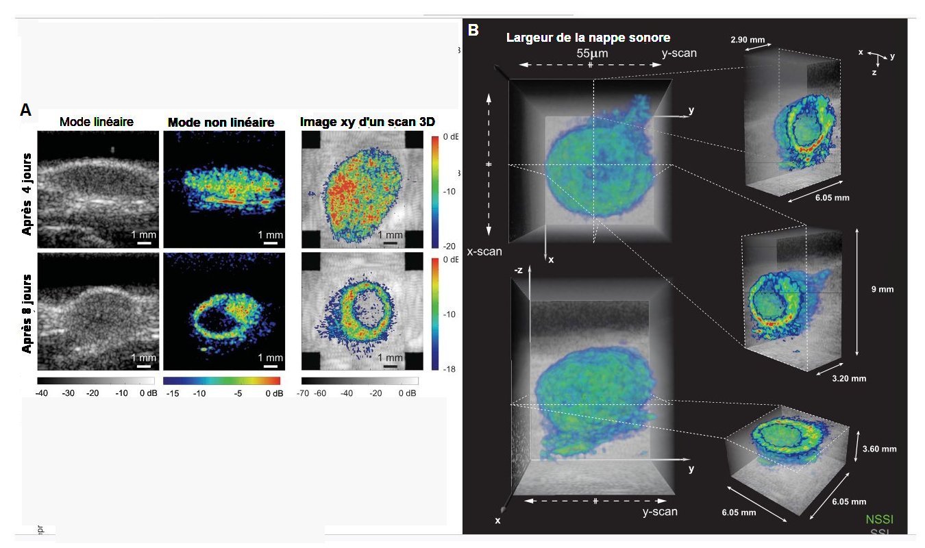 Fig.3 . NSSM donnant l’expression d’un gène de tumeur A) (A gauche) Images de tumeurs âgées de 4 et 8 jours. (Au milieu) Images NSSM révélant la présence d’un rapporteur de gène mammalien (mARG) (A droite) Image xy d’un balayage NSSM orthogonal superposée à une image en linéaire. B) Représentation 3D par NSSM d’une tumeur âgée de 8 jours superposée sur un volume SSM à échelle de gris. Tiré de "Nonlinear sound-sheet microscopy: Imaging opaque organs at the capillary and cellular scale" Baptiste Heiles, Flora Nelissen, Rick Waasdorp, Dion Terwiel, Byung Min Par, Eleonora Munoz Ibarra, Agisilaos Matalliotakis, Tarannum Ara, Pierina Barturen-Larrea, Mengtong Duan, Mikhail G. Shapiro, Valeria Gazzola, David Maresca Science 388, eads1325 (2025). Avec autorisation.